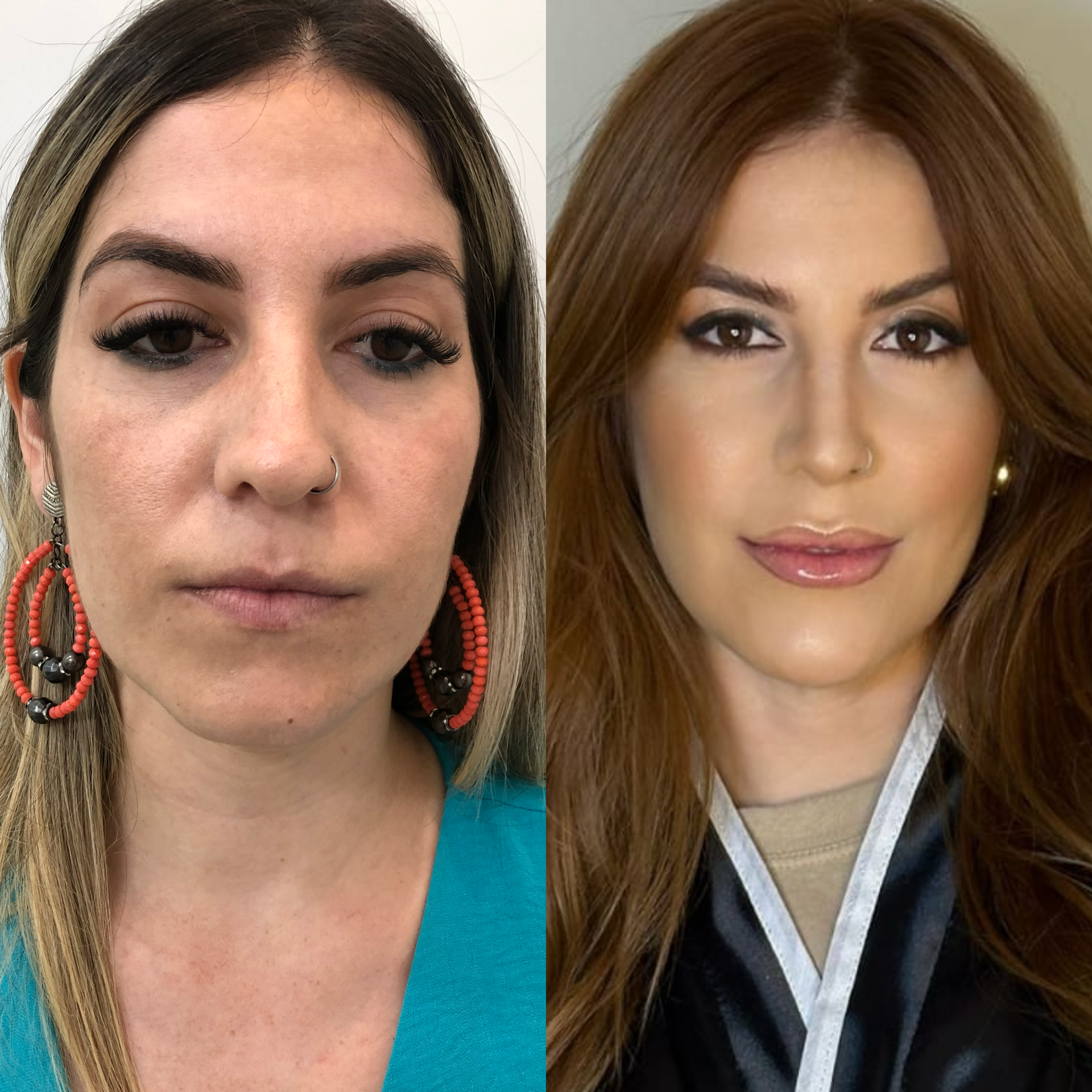 Embelezamento facial 